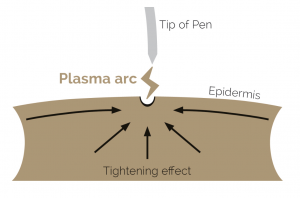 how it works 1 - Plasma Pen