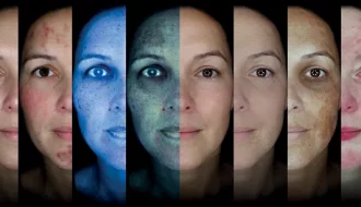 OBSERV1 640w - NEW Skin Scanning available now!