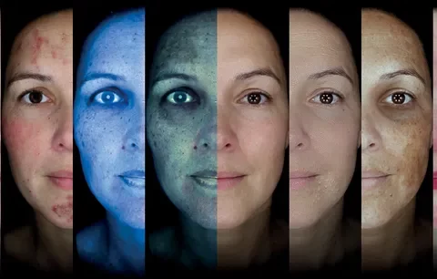 OBSERV1 640w - NEW Skin Scanning available now!