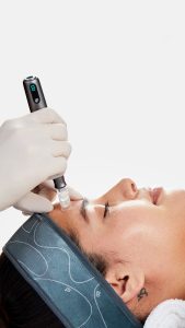 Advanced Skin Treatments 3 Microneedling Model 9x16 6 - Advanced Skin Treatments